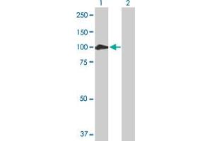 Western Blot analysis of CTNNA2 expression in transfected 293T cell line by CTNNA2 MaxPab polyclonal antibody. (CTNNA2 Antikörper  (AA 1-905))