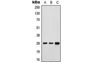 Western blot analysis of FR gamma expression in MCF7 (A), SP2/0 (B), rat brain (C) whole cell lysates.