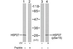 Image no. 2 for anti-Heat Shock 27kDa Protein 1 (HSPB1) (Ser15) antibody (ABIN197344) (HSP27 Antikörper  (Ser15))