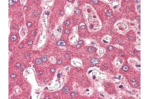 Human Liver (formalin-fixed, paraffin-embedded) stained with TSLPat 2. (Thymic Stromal Lymphopoietin Antikörper)