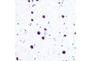 Immunohistochemistry (IHC) image for anti-Microphthalmia-Associated Transcription Factor (MITF) antibody (ABIN7268511)