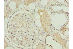 Immunohistochemistry of paraffin-embedded human kidney tissue using ABIN7142385 at dilution of 1:100