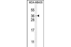 MYCT1 Antibody (C-term) (ABIN654473 and ABIN2844207) western blot analysis in MDA-M cell line lysates (35 μg/lane). (Myc Target 1 Antikörper  (C-Term))