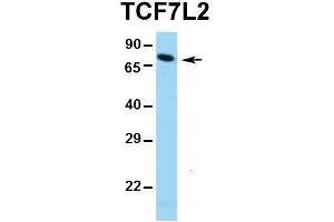 Western Blotting (WB) image for anti-Transcription Factor 7-Like 2 (T-Cell Specific, HMG-Box) (TCF7L2) (Middle Region) antibody (ABIN2777927)