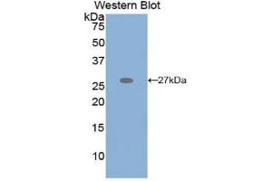 Western blot analysis of the recombinant protein. (GRIP1 Antikörper  (AA 874-1073))
