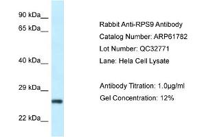Western Blotting (WB) image for anti-Ribosomal Protein S9 (RPS9) (N-Term) antibody (ABIN2788902) (RPS9 Antikörper  (N-Term))