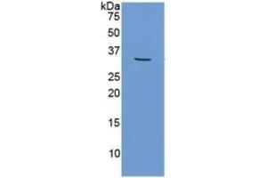 WB of Protein Standard: different control antibodies against Highly purified E.