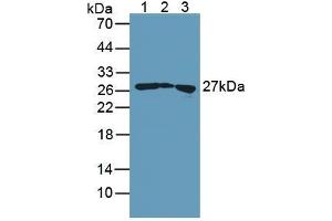 Figure. (Transgelin Antikörper  (AA 1-201))