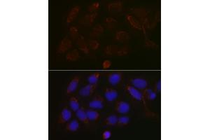 Immunofluorescence analysis of U-2 OS cells using G Rabbit pAb (ABIN6131444, ABIN6140942, ABIN6140944 and ABIN6218180) at dilution of 1:100 (40x lens). (GALNT3 Antikörper  (AA 1-140))