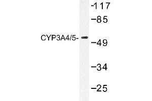 Image no. 1 for anti-Cytochrome P450, Family 3, Subfamily A, Polypeptide 4 (CYP3A4) antibody (ABIN272276) (CYP3A4 Antikörper)