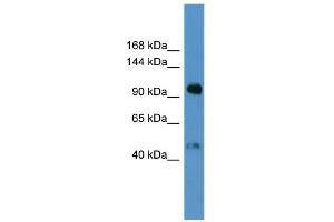 WB Suggested Anti-LPA Antibody Titration: 0. (LPA Antikörper  (N-Term))
