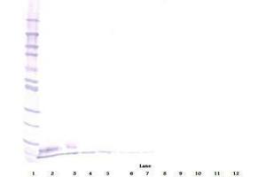 Image no. 2 for anti-Epidermal Growth Factor (EGF) antibody (ABIN465058) (EGF Antikörper)