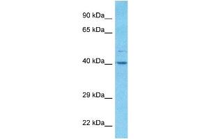 Host:  Rabbit  Target Name:  ALDOA  Sample Type:  RPMI-8226 Whole Cell lysates  Antibody Dilution:  1. (ALDOA Antikörper  (C-Term))