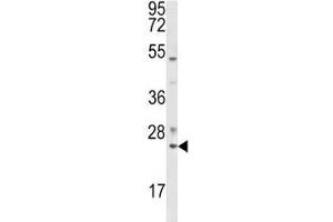 Western blot analysis of RAB7 antibody and K562 lysate. (RAB7A Antikörper  (AA 176-204))