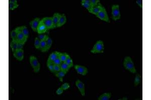 Immunofluorescence staining of HepG2 cells with ABIN7155172 at 1:166, counter-stained with DAPI. (SLC7A1 Antikörper  (AA 430-492))