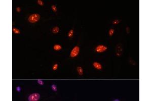 Immunofluorescence analysis of U-2 OS cells using ZNF177 Polyclonal Antibody at dilution of 1:100. (ZNF177 Antikörper)