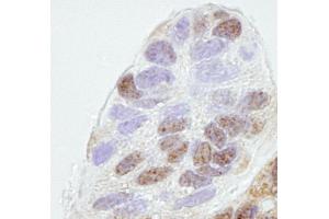 Immunohistochemistry (IHC) image for anti-Prohibitin 2 (PHB2) (AA 1-50) antibody (ABIN7448768) (Prohibitin 2 Antikörper  (AA 1-50))