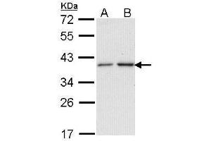 WB Image Sample (30 ug of whole cell lysate) A: A431 , B: H1299 12% SDS PAGE antibody diluted at 1:1000 (NAT2 Antikörper)