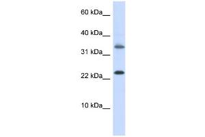 WB Suggested Anti-EMX1 Antibody Titration:  0. (EMX1 Antikörper  (Middle Region))