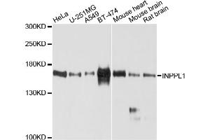 Western blot analysis of extracts of various cell lines, using INPPL1 antibody (ABIN4904065) at 1:1000 dilution. (INPPL1 Antikörper)