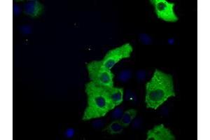 Image no. 7 for anti-Transforming, Acidic Coiled-Coil Containing Protein 3 (TACC3) antibody (ABIN1498099) (TACC3 Antikörper)