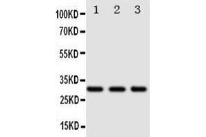 Anti-DR4 antibody, Western blotting Lane 1: SW620 Cell Lysate Lane 2: COLO320 Cell Lysate Lane 3:  Cell Lysate