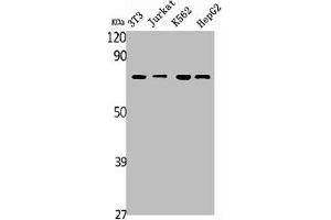 Western Blot analysis of NIH-3T3 Jurkat K562 HepG2 RAT-KIDNEY cells using SDHA Polyclonal Antibody (SDHA Antikörper  (C-Term))