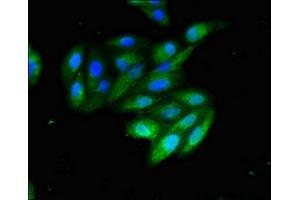 Immunofluorescent analysis of HepG2 cells using ABIN7147139 at dilution of 1:100 and Alexa Fluor 488-congugated AffiniPure Goat Anti-Rabbit IgG(H+L) (ITGB1 Antikörper  (AA 297-380))