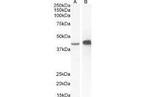 (ABIN2613379) (0. (AMACR Antikörper  (C-Term))