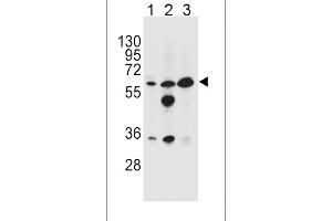 Western blot analysis in HL-60(lane 1),MDA-MB453(lane 2),K562(lane 3) cell line lysates (35ug/lane).