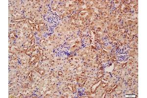 Formalin-fixed and paraffin embedded rat kidney labeled with Anti-Beclin 1/ATG6 Polyclonal Antibody, Unconjugated  at 1:200 followed by conjugation to the secondary antibody and DAB staining (Beclin 1 Antikörper  (AA 201-330))