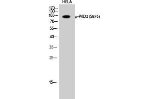 Western Blotting (WB) image for anti-Polycystic Kidney Disease 2 (Autosomal Dominant) (PKD2) (pSer876) antibody (ABIN5962048) (PKD2 Antikörper  (pSer876))