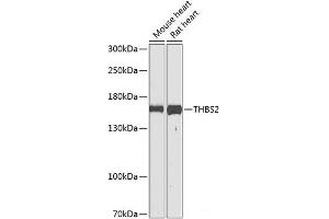 Western blot analysis of extracts of various cell lines using THBS2 Polyclonal Antibody at dilution of 1:1000. (Thrombospondin 2 Antikörper)