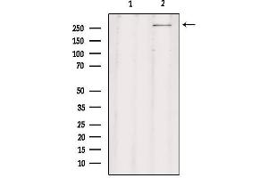 Western blot analysis of extracts from rat brain, using CHD8 Antibody. (CHD8 Antikörper  (C-Term))