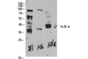 Western Blotting (WB) image for anti-Nuclear Factor of kappa Light Polypeptide Gene Enhancer in B-Cells Inhibitor, alpha (NFKBIA) (N-Term) antibody (ABIN3175722) (NFKBIA Antikörper  (N-Term))
