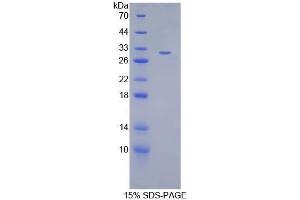 SDS-PAGE analysis of Mouse ANGPTL2 Protein. (ANGPTL2 Protein)
