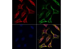 ABIN6265555 and ABIN6266853 staining Hela by IF/ICC. (Transglutaminase 2 Antikörper  (N-Term))