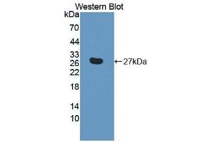 Detection of Recombinant ASPH, Human using Polyclonal Antibody to Aspartate Beta Hydroxylase (ASPH) (Aspartate beta Hydroxylase Antikörper  (AA 562-753))