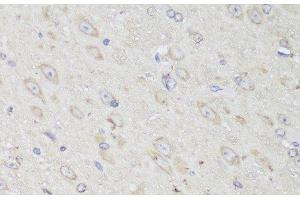 Immunohistochemistry of paraffin-embedded Mouse brain using GANAB Polyclonal Antibody at dilution of 1:150 (40x lens). (GANAB Antikörper)