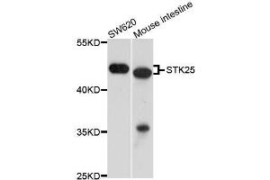 Western blot analysis of extracts of various cell lines, using STK25 antibody (ABIN5996002) at 1/1000 dilution. (STK25 Antikörper)
