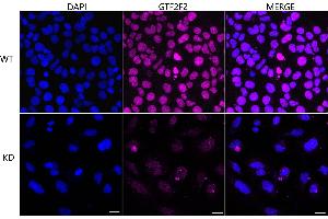 Immunocytochemical staining of HeLa cells using GTF2F2 antibody (ABIN7798708), 1:1,000), Top panel: wild-type (WT), Bottom panal: GTF2F2 shRNA knockdown (KD). (Rekombinanter GTF2F2 Antikörper)
