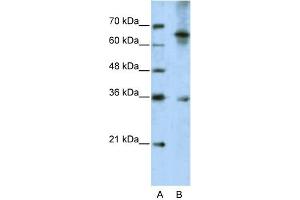 WB Suggested Anti-WNT9B Antibody Titration:  5. (WNT9B Antikörper  (C-Term))