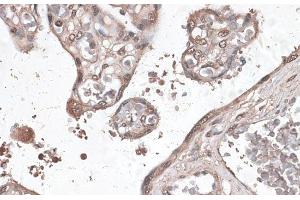 Immunohistochemistry of paraffin-embedded Human placenta using MEF2C Polyclonal Antibody at dilution of 1:100 (40x lens). (MEF2C Antikörper)