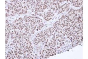 Immunohistochemistry (IHC) image for anti-Nuclear Receptor Subfamily 0, Group B, Member 2 (NR0B2) antibody (ABIN2856933)