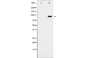 Western blot analysis of ADAM 17 phosphorylation expression in K562UV treated whole cell lysates,The lane on the left is treated with the antigen-specific peptide. (ADAM17 Antikörper  (pThr735))