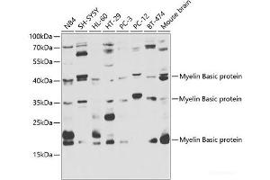 Western blot analysis of extracts of various cell lines using Myelin Basic protein Polyclonal Antibody at dilution of 1:1000.