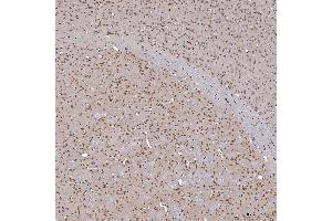 IHC analysis of TRMT61A using anti-TRMT61A antibody (ABIN7599220).