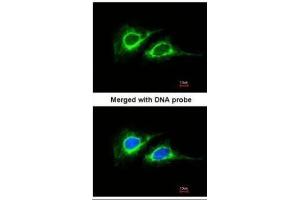 ICC/IF Image Immunofluorescence analysis of paraformaldehyde-fixed HeLa, using Cytokeratin 18 , antibody at 1:200 dilution. (Cytokeratin 18 Antikörper)