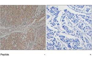 Image no. 1 for anti-SMAD, Mothers Against DPP Homolog 3 (SMAD3) (Ser208) antibody (ABIN319357) (SMAD3 Antikörper  (Ser208))