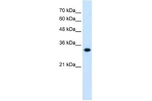 HMGCL antibody used at 0. (HMGCL Antikörper)